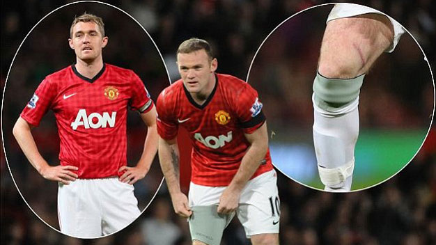 CẬN CẢNH vết thương mới lành của Rooney