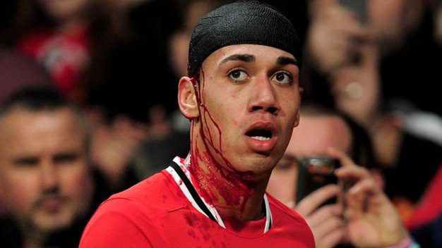 Tin vui cho M.U: Smalling chuẩn bị trở lại Tin vui cho M.U: Smalling chuẩn bị trở lại