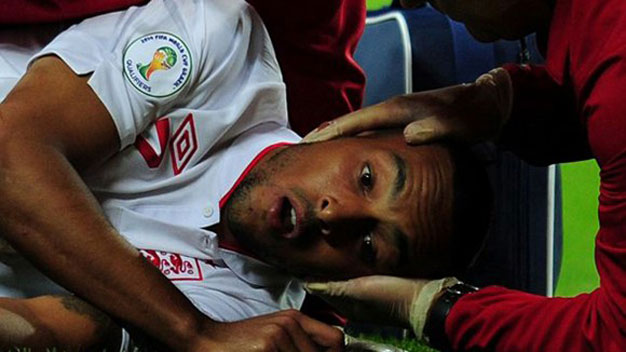 Chấn thương của Walcott được ví với 