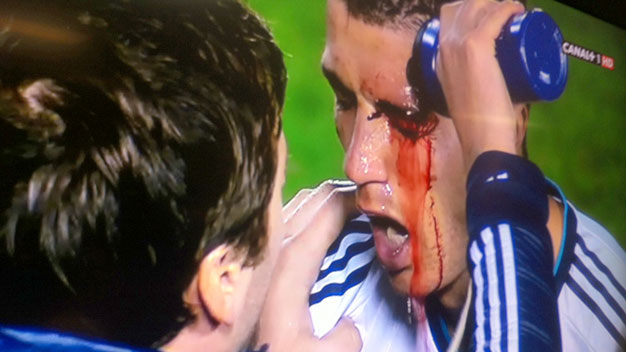 Điểm tin trưa 12/11: Ronaldo rách mắt vì bị Điểm tin trưa 12/11: Ronaldo rách mắt vì bị