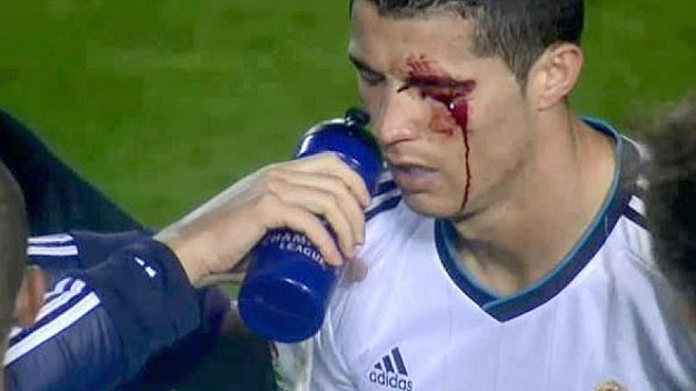 Navarro khẳng định không cố ý làm đau Ronaldo Navarro khẳng định không cố ý làm đau Ronaldo