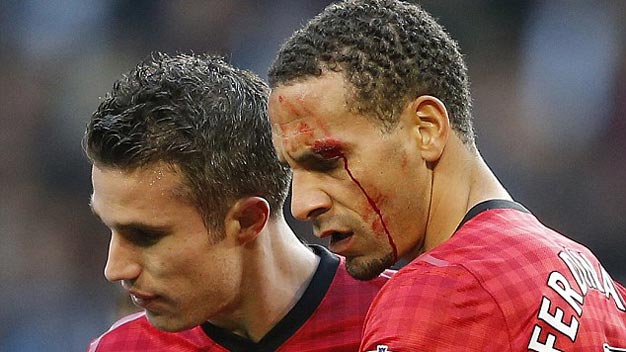 Hậu derby Manchester: FA điều tra vụ Rio đổ máu tại Etihad