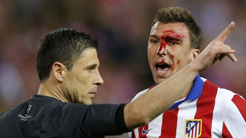 Mandzukic 